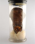 Uterus
